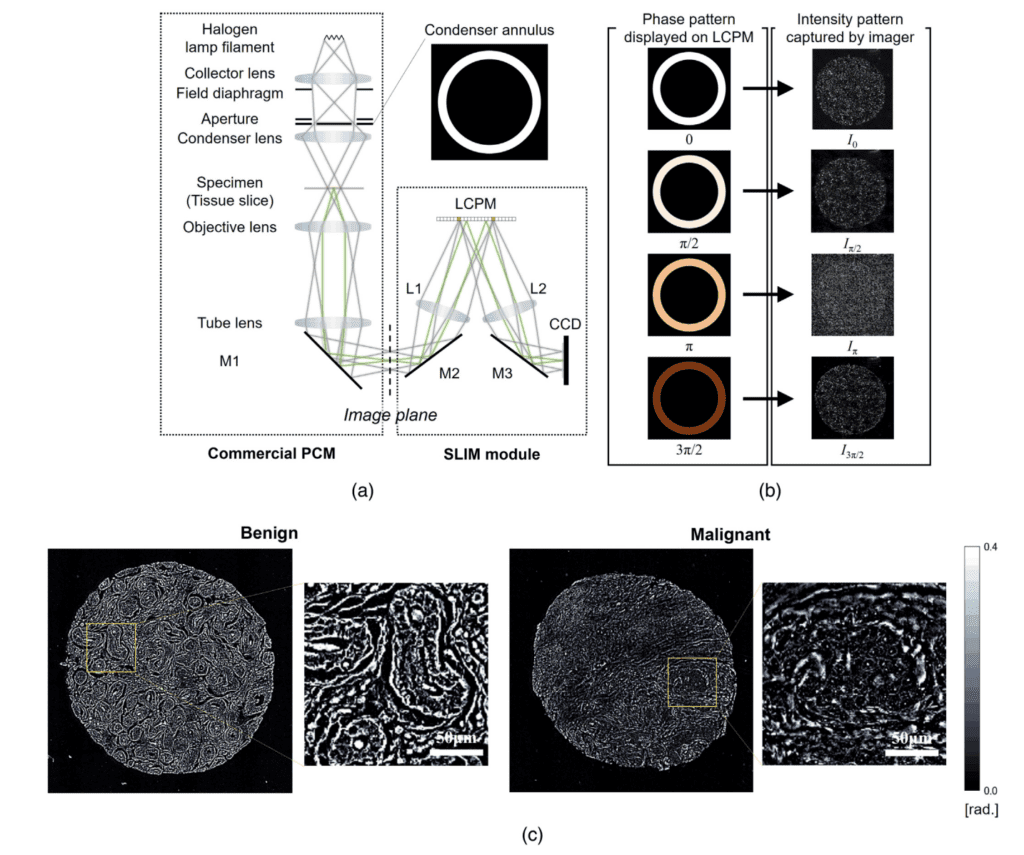 120. Tissue Spatial Correlation as Cancer Marker; Journal of Biomedical
